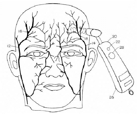 Scanning-the-temporal-artery.png