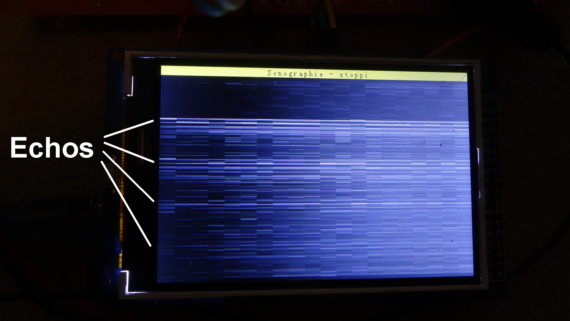 Sonographie_Arduino_125.JPG