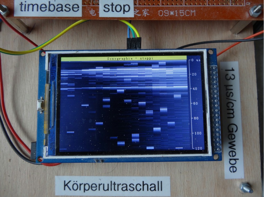 Sonographie_Arduino_217.jpg