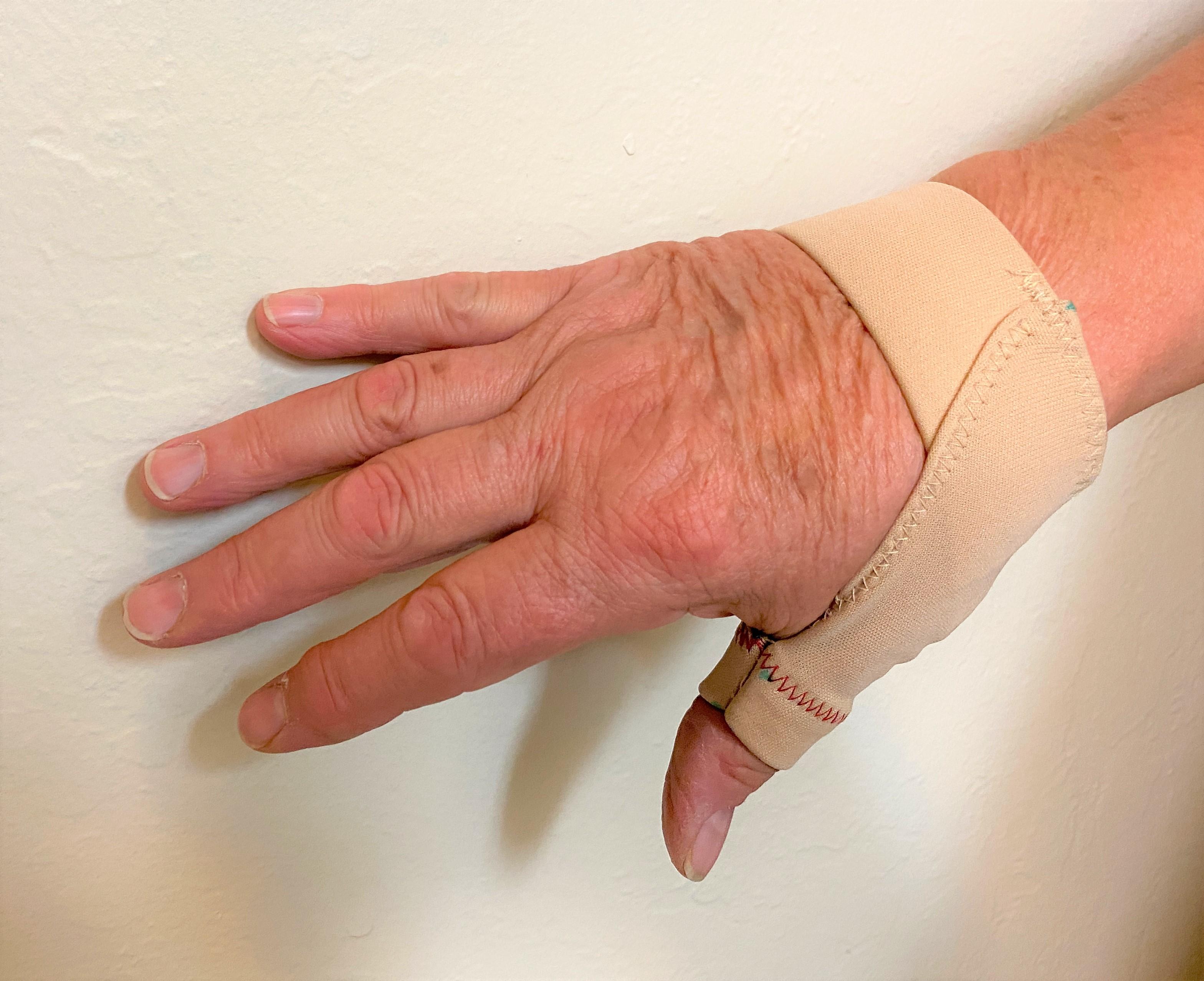 Splint(41).JPG