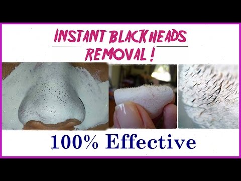 THIS One Easy Trick Can Get Rid Of All Those Annoying Blackheads Instantly! Skin care tips video