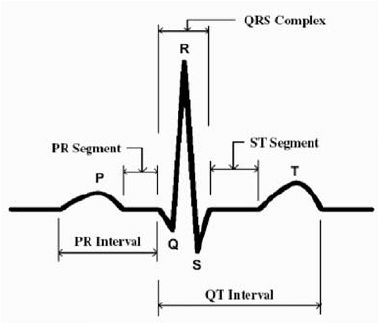 The-components-of-ECG-signal.png