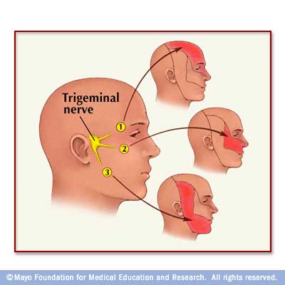 Trigeminal Nerve 3.jpg