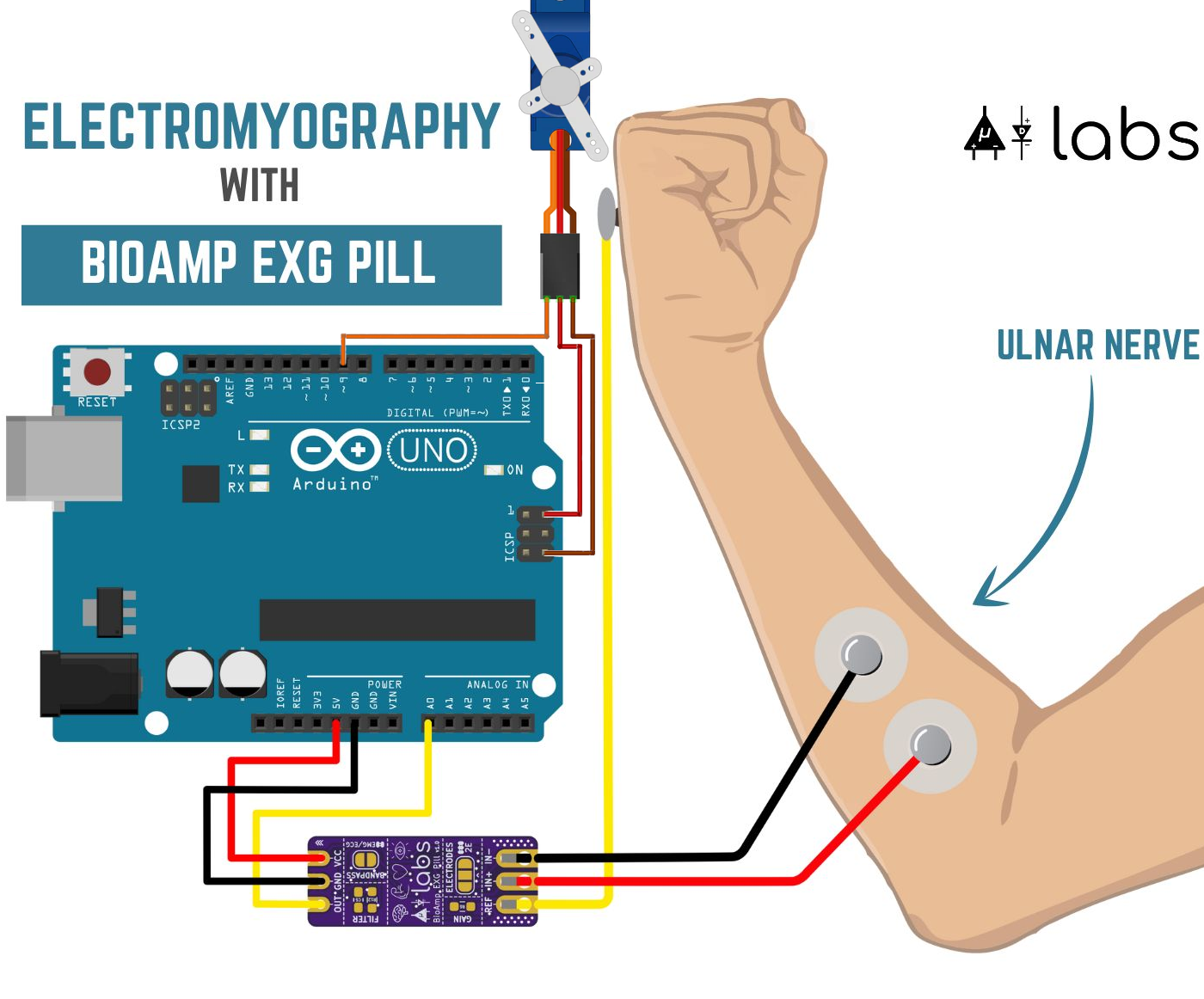 UDL-EMG-BioAmp-EXG-Pill-Forearm-1-crop-with-servo-65.png