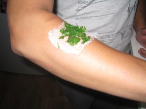 burdock on arm.jpg