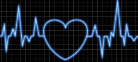 ecg picture.JPG