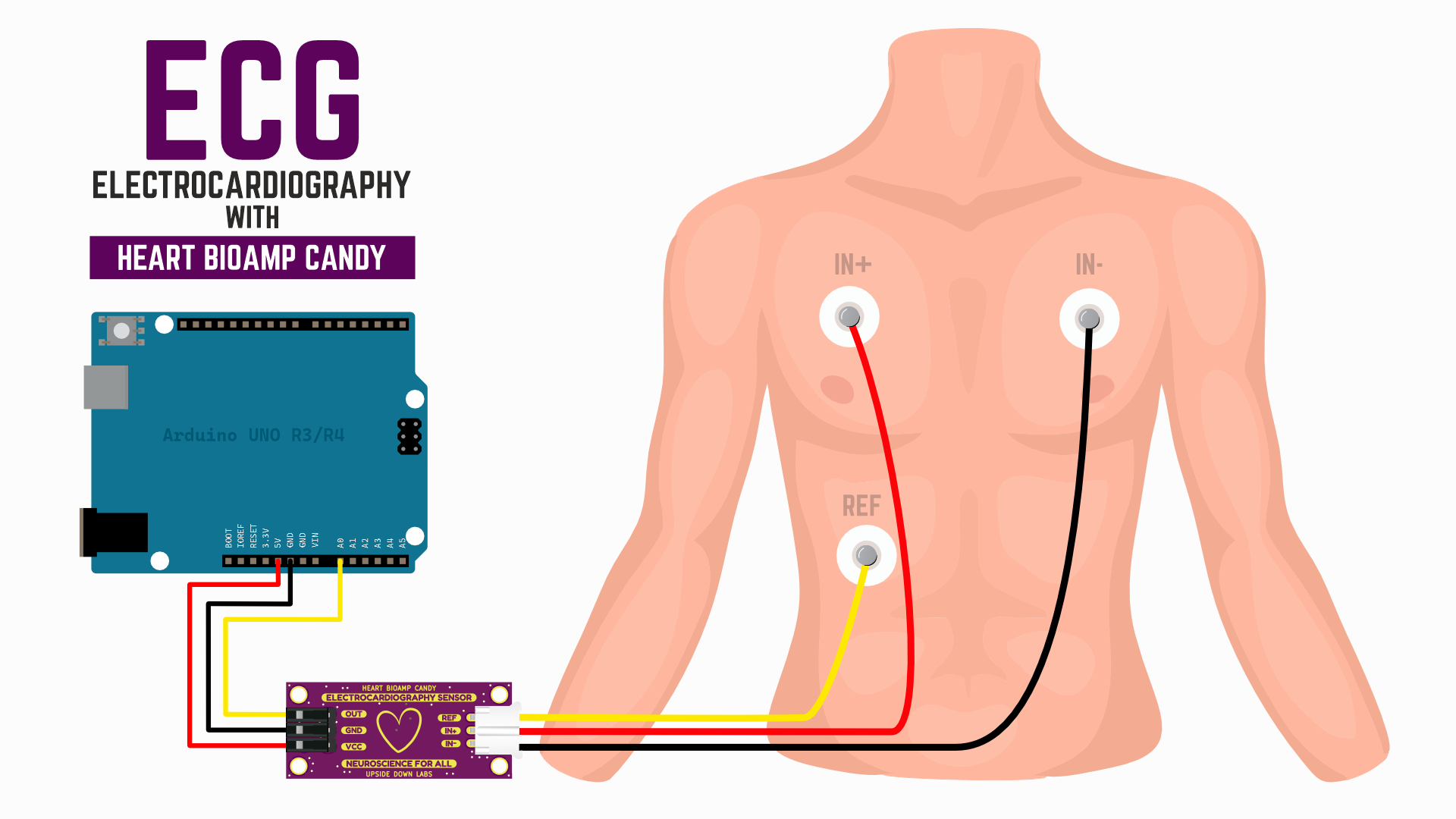 ecg-using-gel-electrodes.png