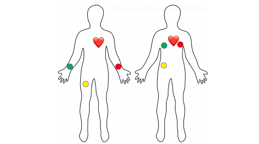 ecg_electrodes.png