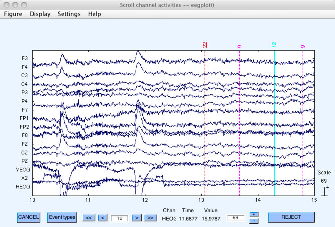 eeg2.jpg