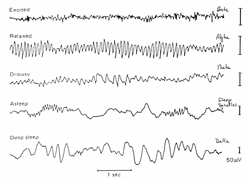 eeg_traces_01.gif