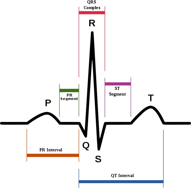 ekg.jpg