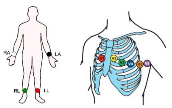 electrode placement.PNG