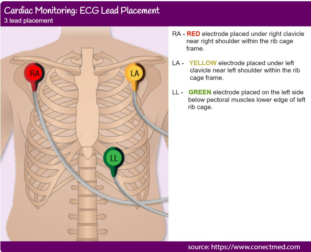 electrodes_source.png