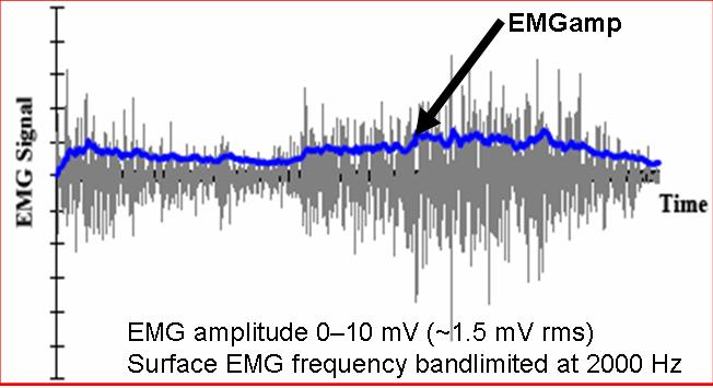 emgsignal.jpg