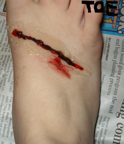 foot gel blood 1.jpg