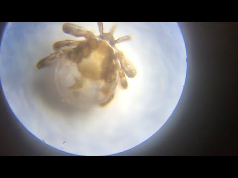 how SMALL are deer ticks and how to PROTECT ourselves from them (lyme disease)