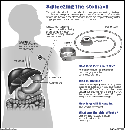 lapband_1.jpg
