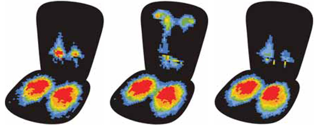 se_pressure_distribution_fig4&amp;5&amp;6.jpg