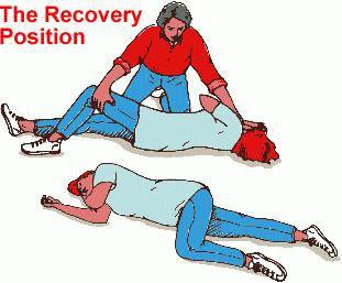 seizure-recovery-position.jpg