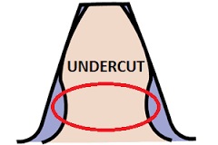 undercut.jpg