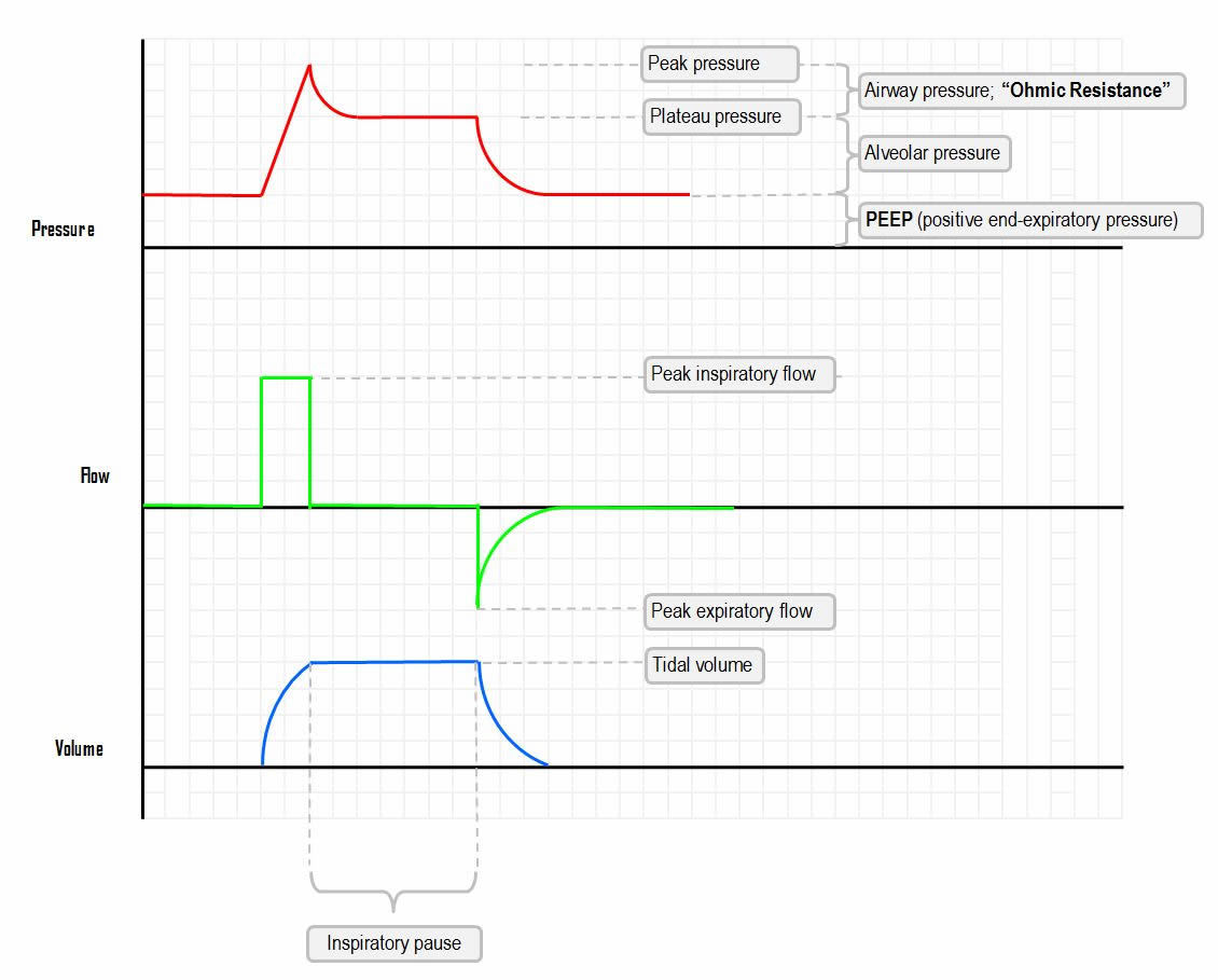 ventilator waveform.jpg