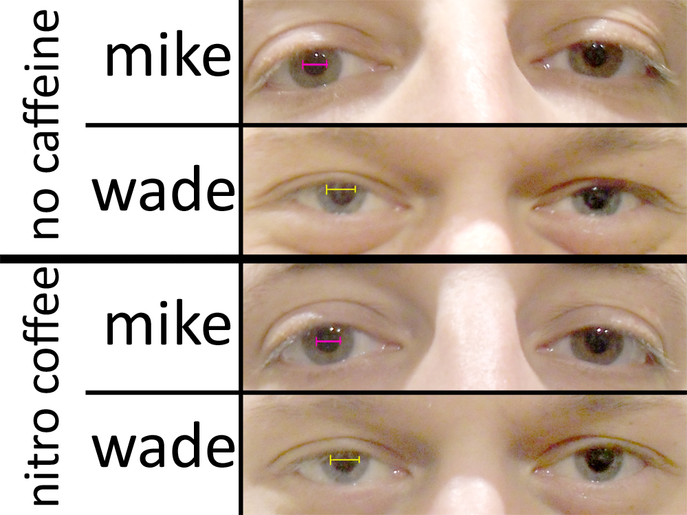 xxeyetest.jpg