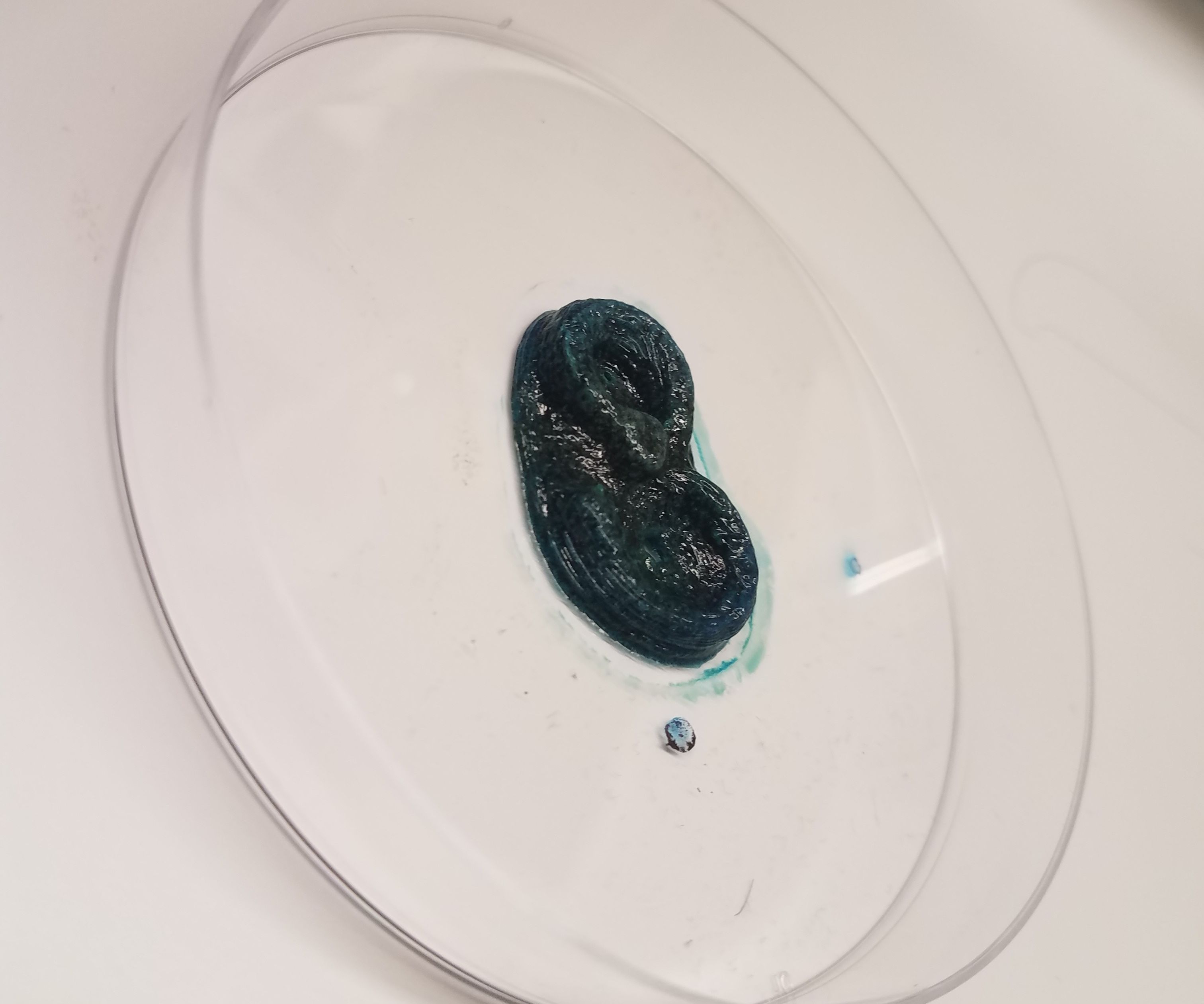 Human Meniscus 