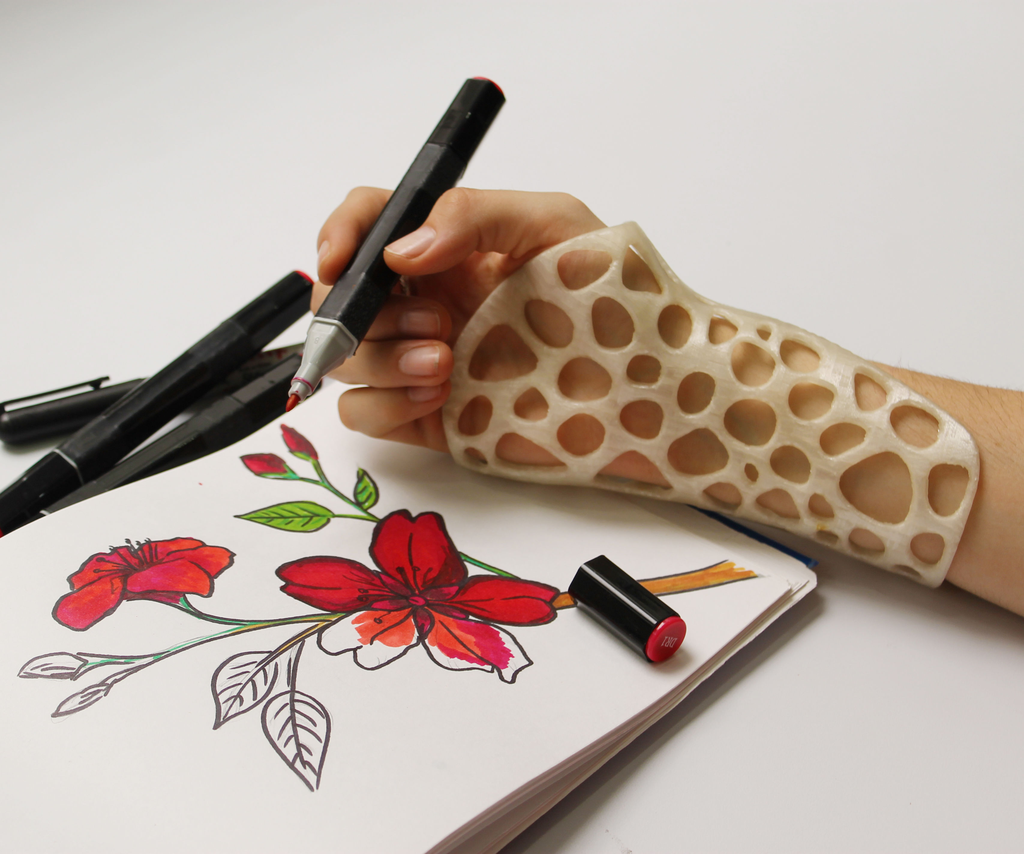 3D Printed Wrist Orthosis