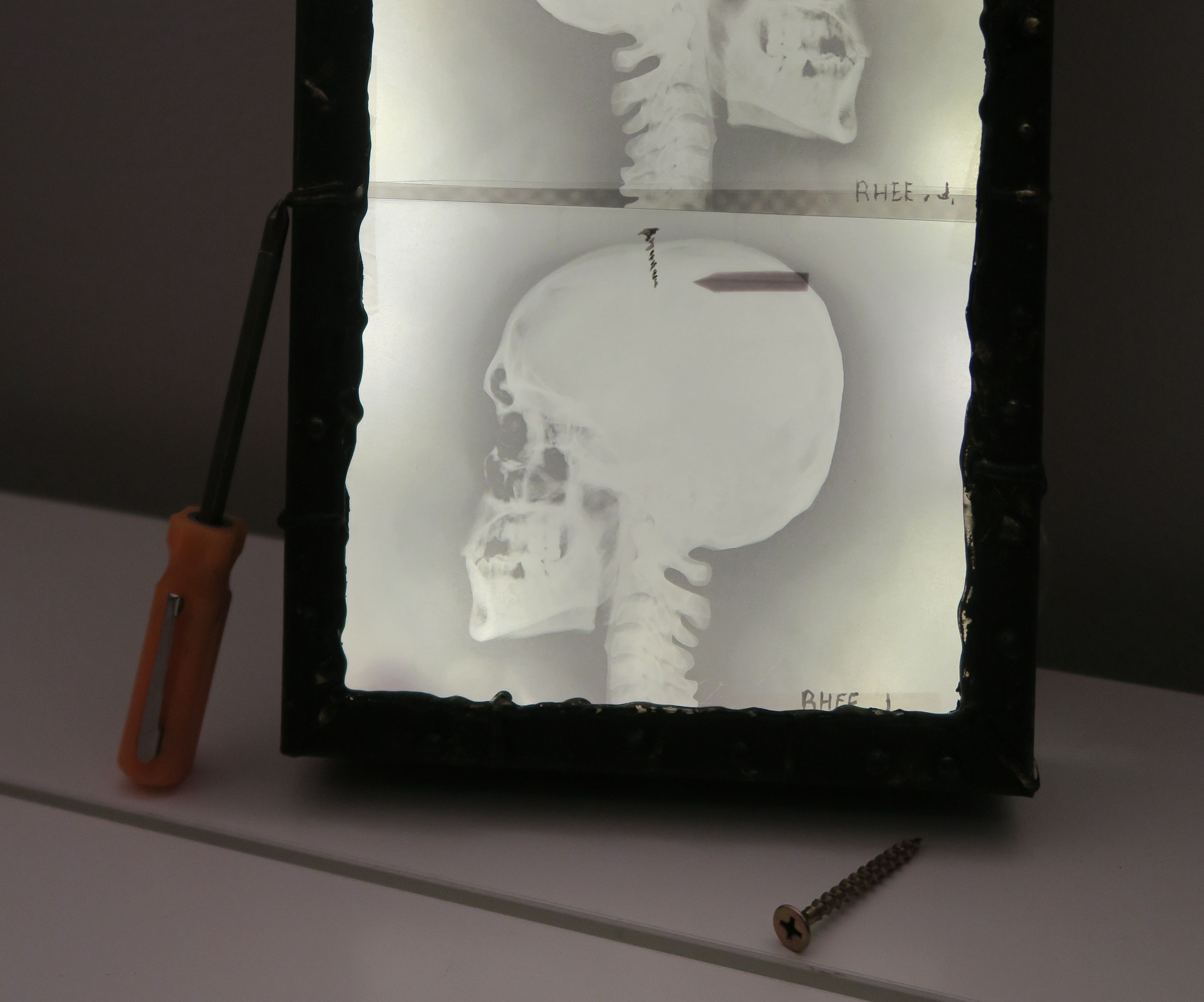 X-Ray Light