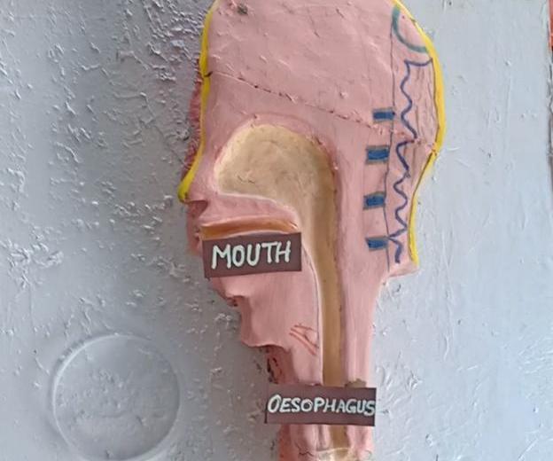 Upset Stomach?