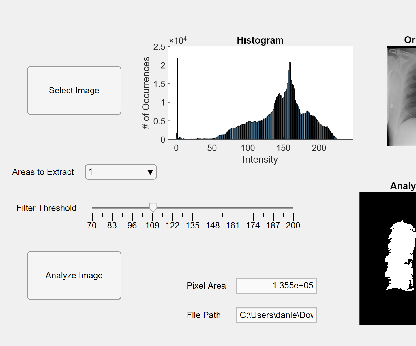 MatLab Lung Segmentation