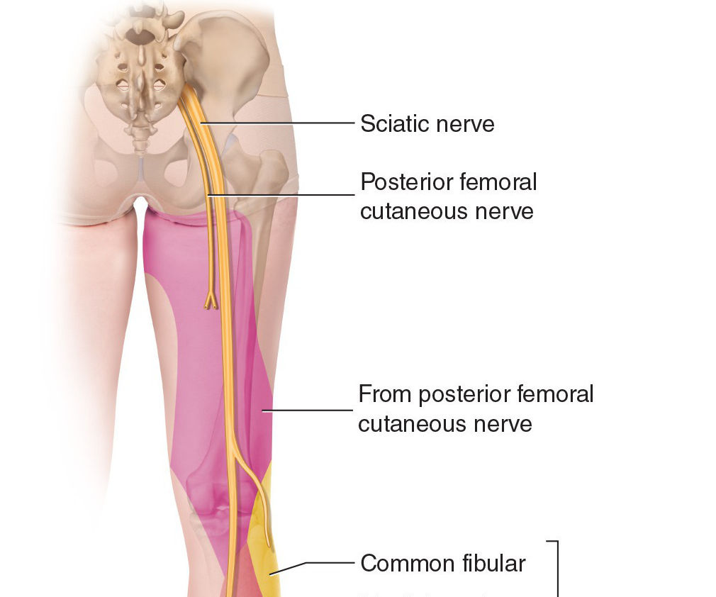 How to Help With Sciatic Nerve Pain
