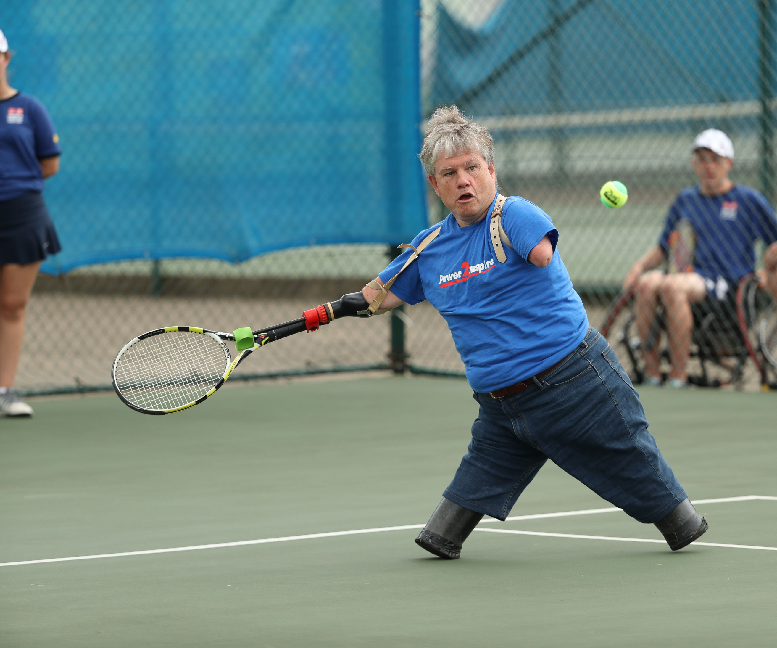Tennis Prosthetic
