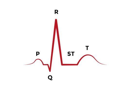 Electrocardiogram (ECG) Circuit 