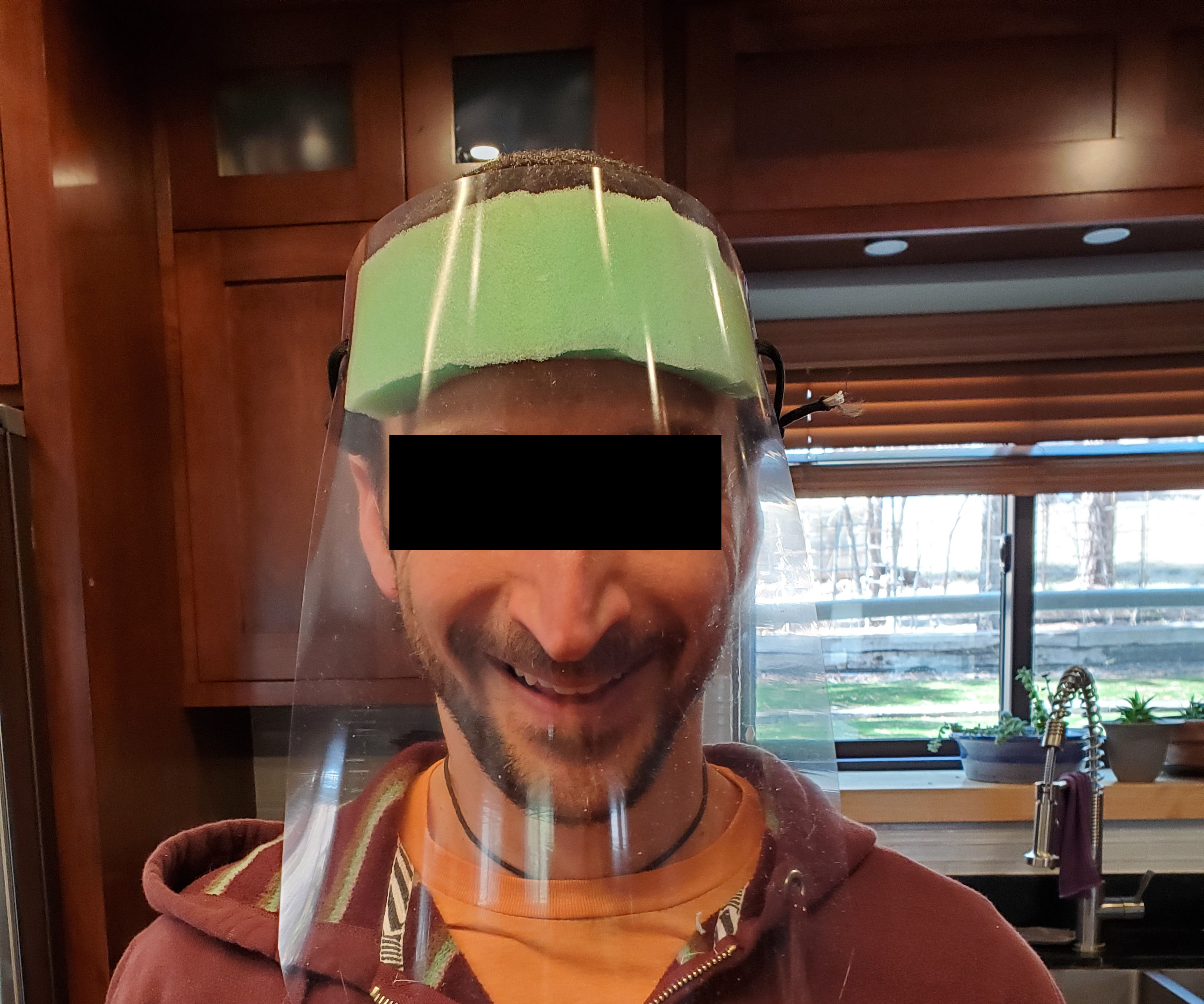 Face Shield for Infection Control (covid-19)
