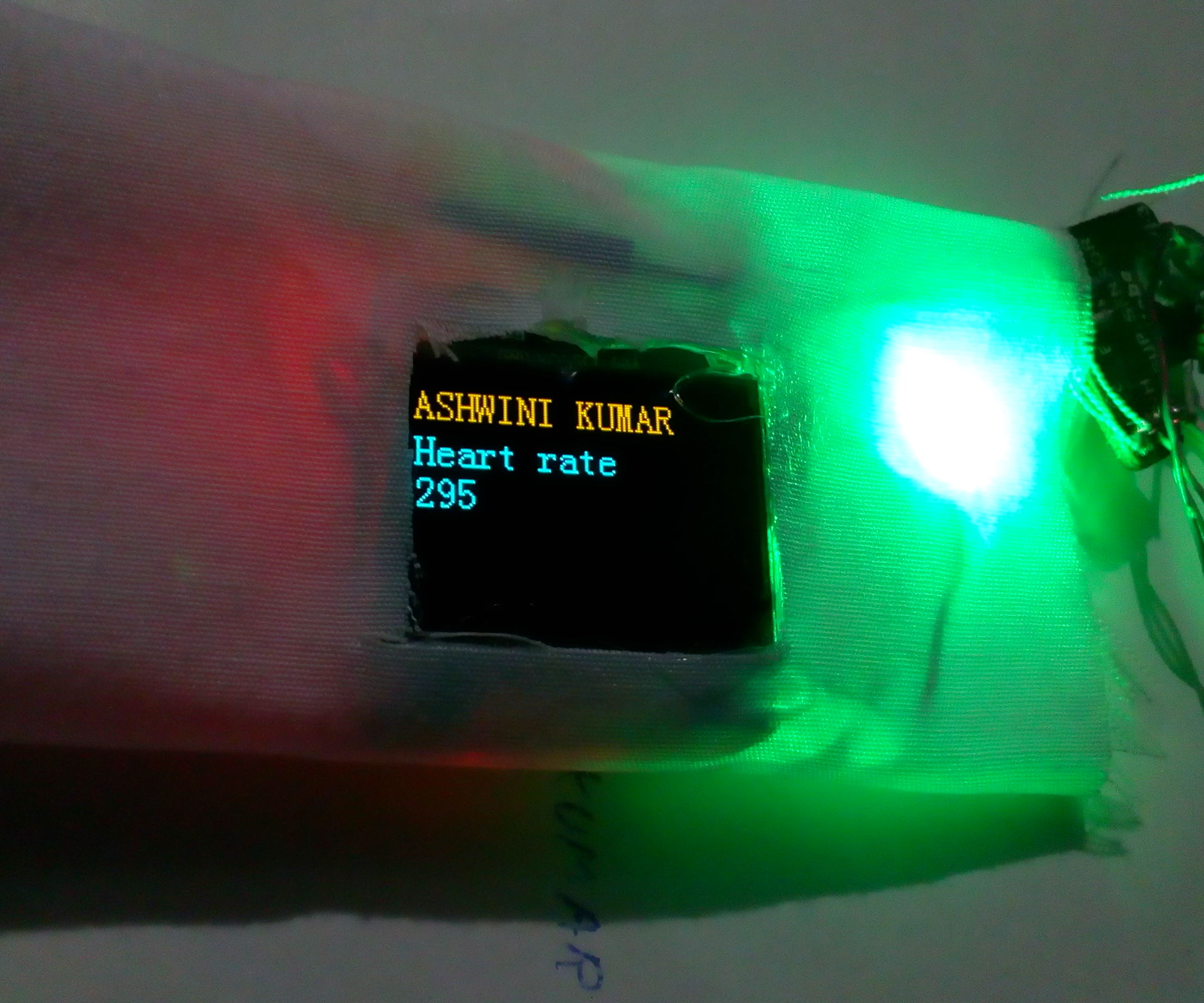 Smart Wearable and Id Card See Your Heartbeat Feel It