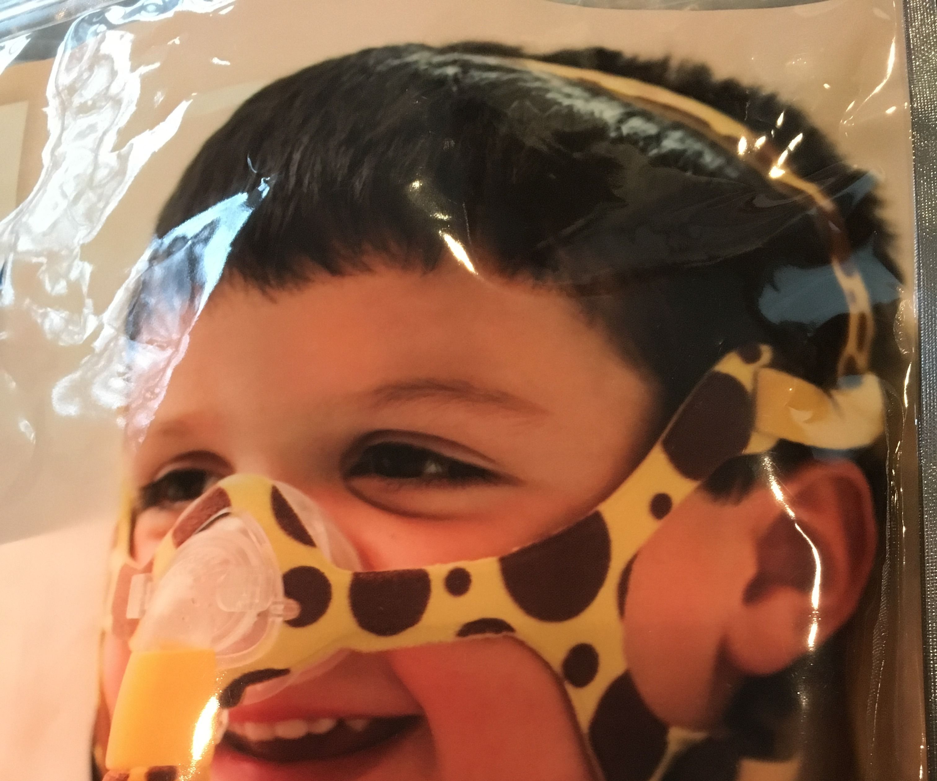 DIY BiPap Mask From a Wisp 