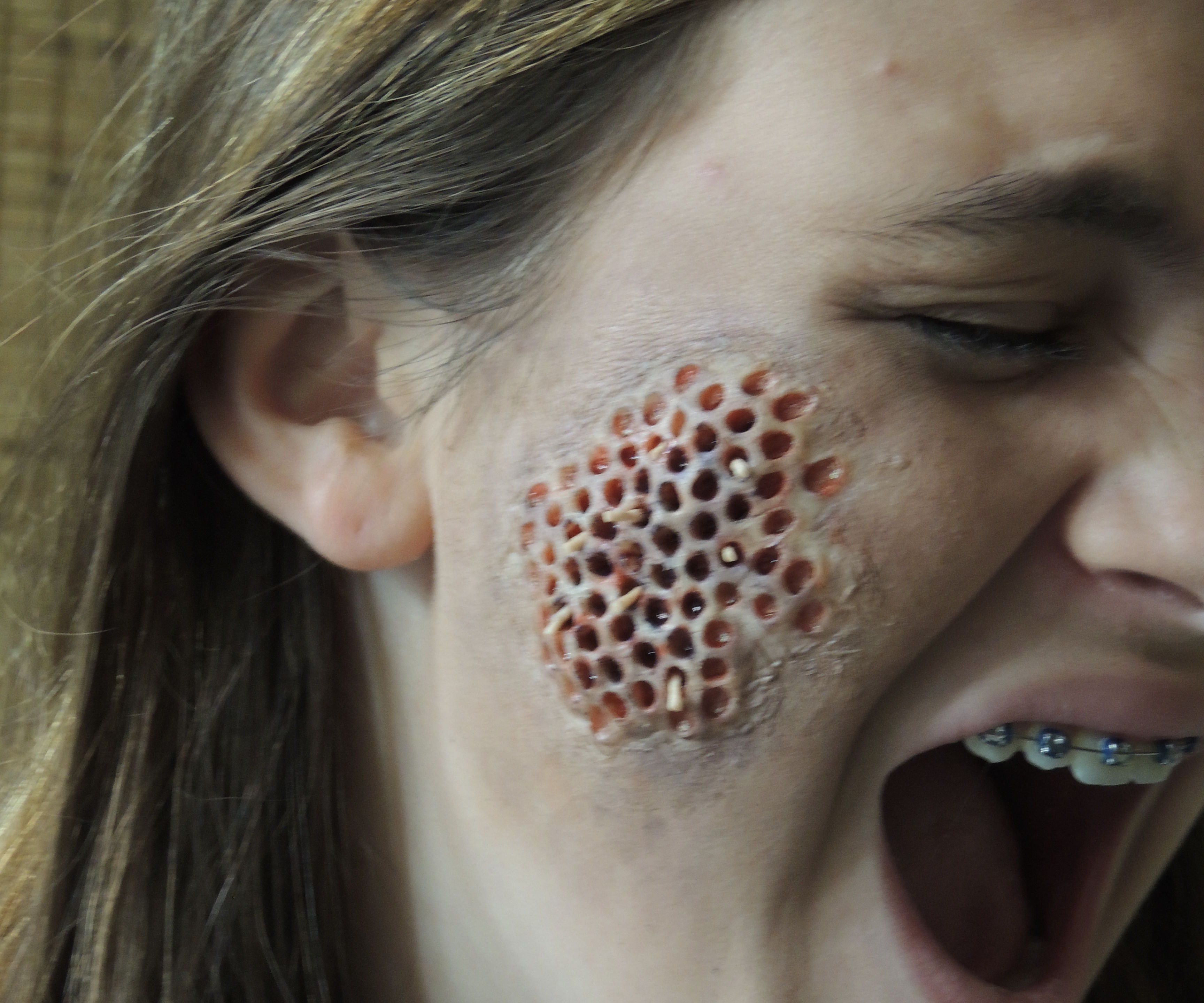 Maggot Infested Skin (Trypophobia) Doctor Costume