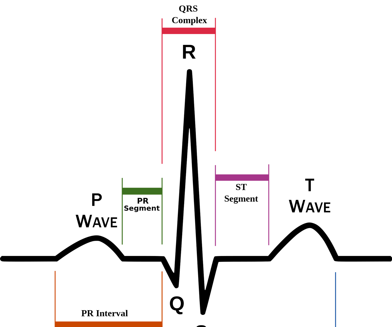 ECG Monitor