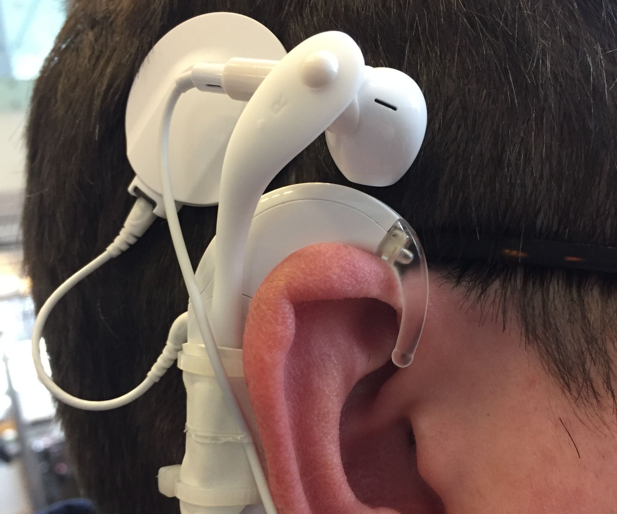 CiPod: Earbud Attachment for Cochlear Implants