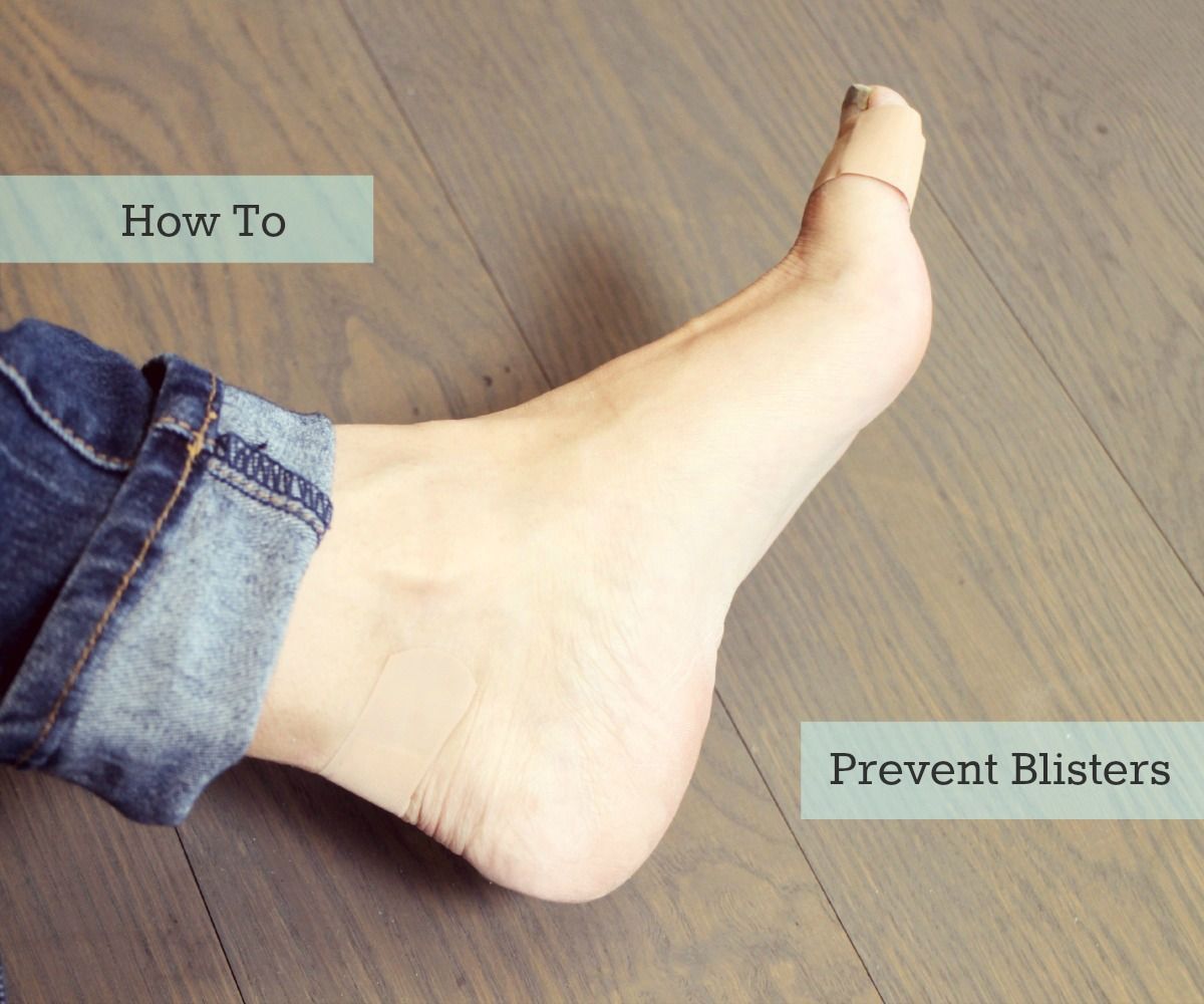 Prevent Blisters