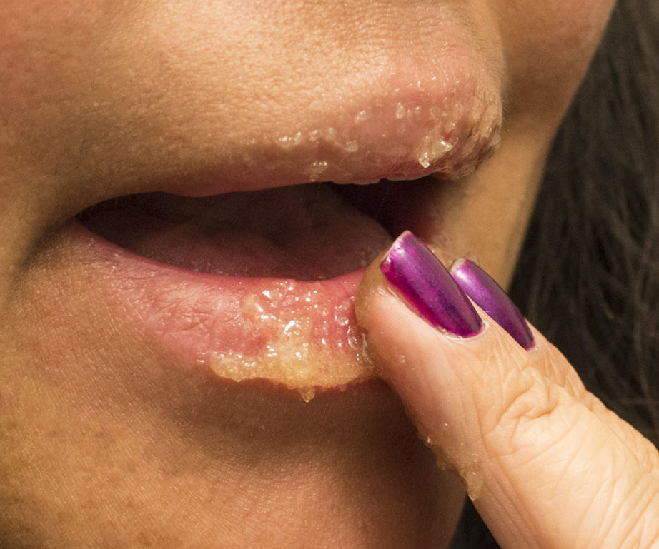 All Natrual Lip Scrub